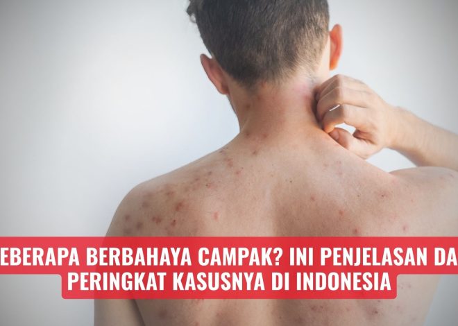 Seberapa Berbahaya Campak? Ini Penjelasan dan Peringkat Kasusnya di Indonesia